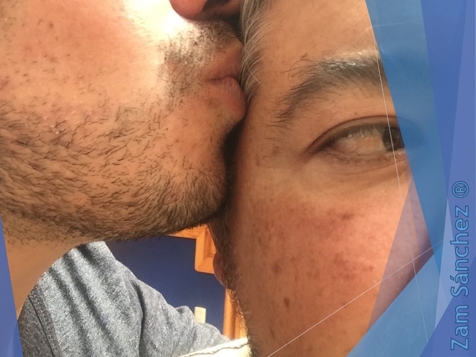 Beso Zam